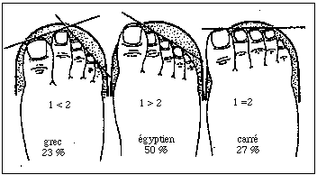 Quels sont les différents types de pieds?